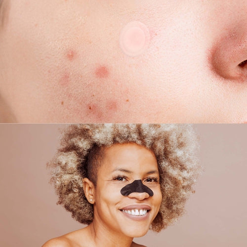 Pursonic Charcoal Pore Strips & Blackhead Remover Set