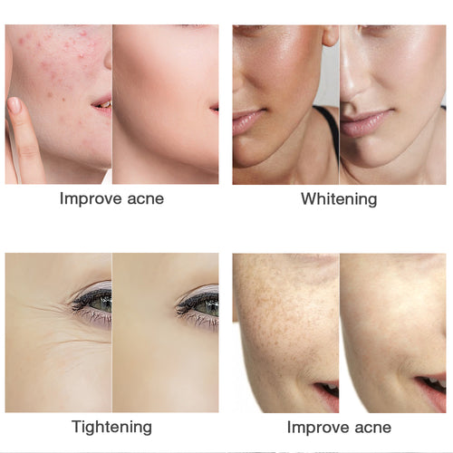 Color LED Photon Light Therapy Facial Shield